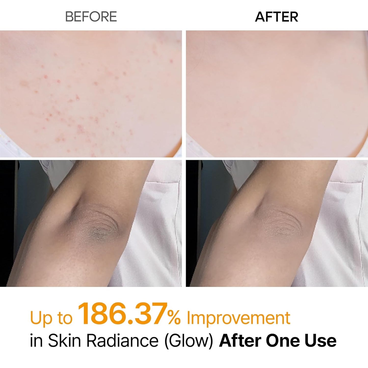 Exfoliante Corporal Spray Kojic y Cúrcuma