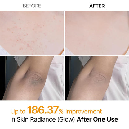 Exfoliante Corporal Spray Kojic y Cúrcuma